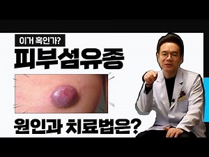 Should I treat the hard lumps appearing on my body? #SkinFibroma, #SkinFibromaRemoval, #SkinFibro...
