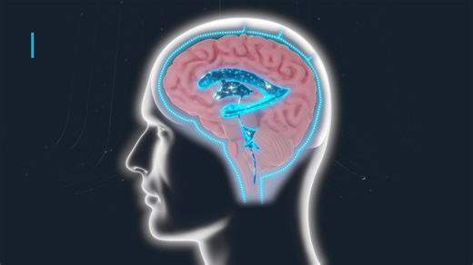 The more people know about hydrocephalus, the stronger our community becomes! Share this video with your friends and family, and challenge them to complete our Hydrocephalus Awareness Month quizzes! https://forms.gle/HmbXTtP4AsSs9emF6 #HAM2025 #HAM25 #HydrocephalusAwarenessMonth #Hydrocephalus | Hydrocephalus Association