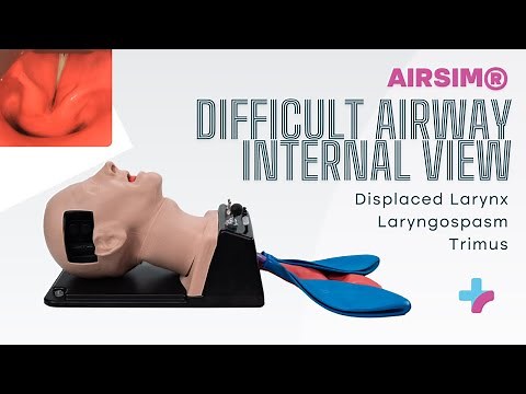 Difficult Airway Internal View