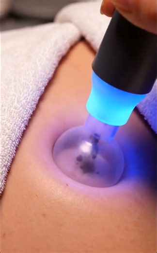 Inner Thigh Crease ASMR ✨ Blue-Light Vacuum Skincare #asmr #skincare #macroasmr #macroasmr #beauty