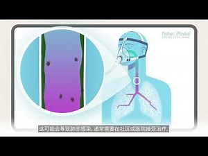 湿度如何对肺部提供呼吸支持 | F&P Healthcare