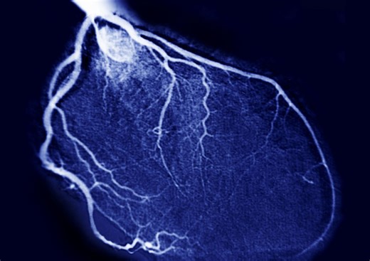 ‘Don’t ignore the signs’: Cardiologist warns subtle symptoms can signal heart disease