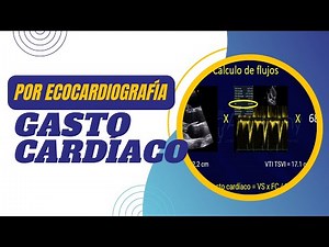 💡💚GASTO CARDÍACO por ECOCARDIOGRAFÍA [Paso a Paso]