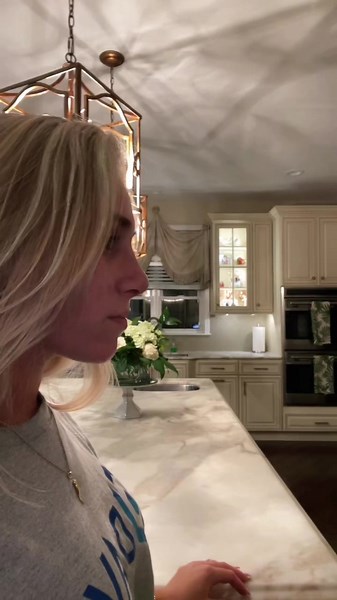 nose job check #rhinoplasty #septoplasty #drcorrado