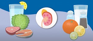 Learn to Prevent Recurring Kidney Stones