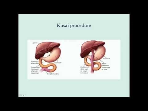 Newborn Direct Hyperbilirubinemia - CRASH! Medical Review Series