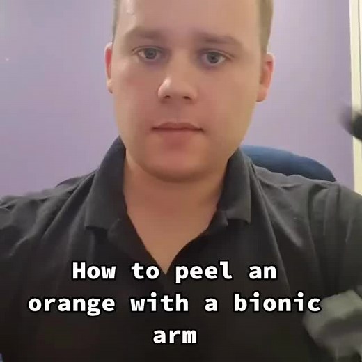 Bionic skills 🦾 #bionic #limbdifferent #onearm #skillschallenge #fypage #techforgood #tech #heroarm