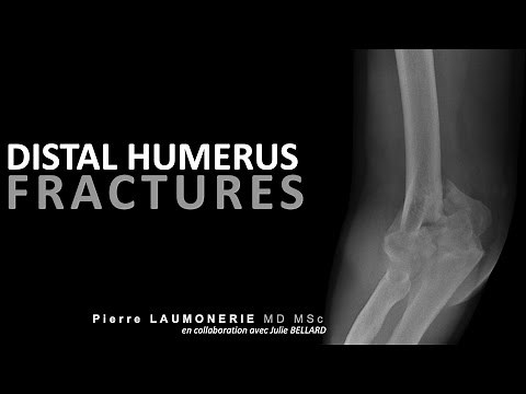 Fractures de la palette humérale / fracture of the distal humerus
