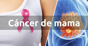 Hay al menos 7 señales que te pueden prevenir a tiempo de la existencia de un tumor en el pecho.
