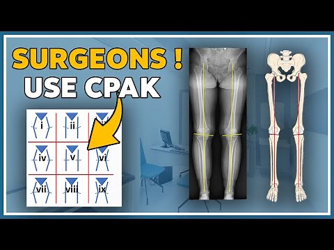 Alignment of the knee with the CPAK classification