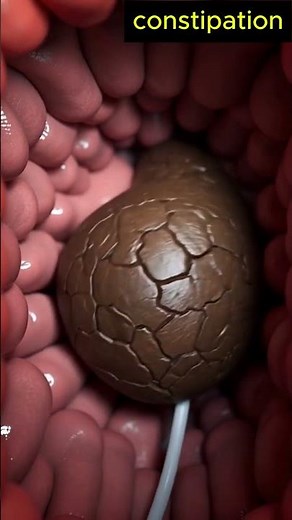 Slow Motion Constipated Stool Exit – Human Anatomy | 142