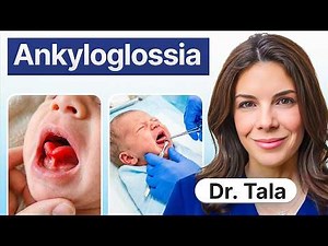 TONGUE-TIES: 10 Clinical Take-Home Points (Everyone Should Know)