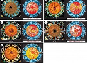 An Amoeba-Based Computer Calculated Approximate Solutions to a Very Hard Math Problem