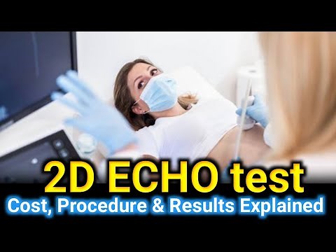 2D Echo Test – Cost, Procedure & Results Explained #2decho #echo