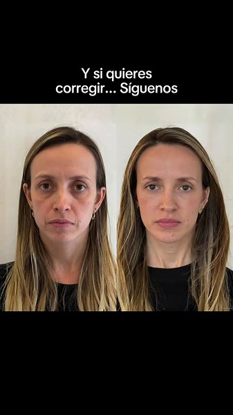 Cómo Caminar Afecta tu Rostro: La Conexión con tu Mandíbula