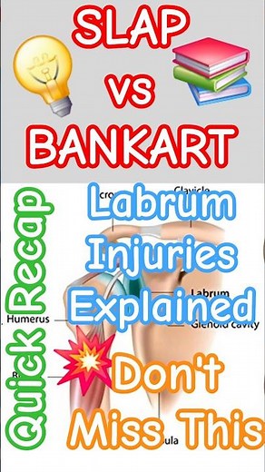 SLAP vs Bankart Lesion | Quick Breakdown | Labrum Injuries #physiotherapy #shorts