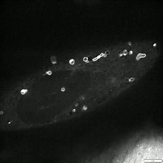 Synchronized Imaging at High SpeedFeaturing a fast frame rate for super-resolution imaging, Evident Microscopy IXplore IX85 SpinSR rapidly acquires dynamic cellular events at the nanoscale with XY… | Miguel Angelo Oliveira