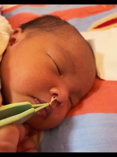 Effective Booger Removal Techniques for a Clean Nose
