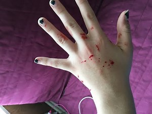 Blood python gone wrong