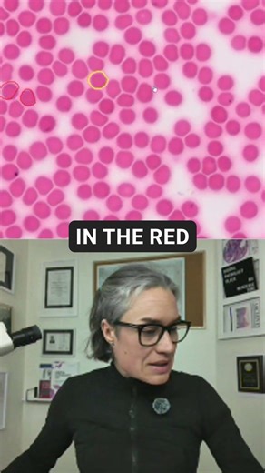 Red Blood Cells | Human Blood under the microscope