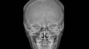 Detailed X-Ray of Human Skull