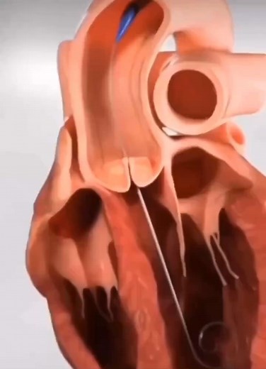 76K views · 862 reactions | Nice music. What is the description or Procedure? | Cardiophilia | Facebook