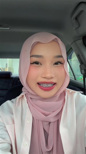 Braces Day One: Before and After Transformation