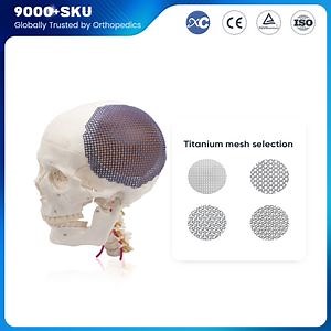[Hot Item] Titanium Mesh Cranial Titanium Mesh Orthopedic Implant for Skull Cranioplasty