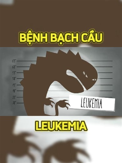 Bệnh bạch cầu - Leukemia #LearnOnTikTok #FYP #health #xuhuong #songkhoemoingay