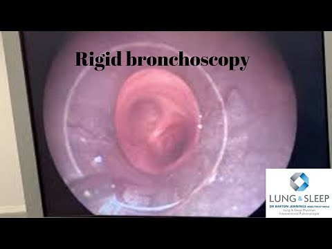 Rigid bronchoscopy and lung mass in the right upper lobe