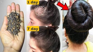 160K views · 5.6K reactions | Japanese secret, to grow hair and treat baldness from the first week #hairgrowth #hair #haircare #hairfall #hairtips #longhair #hairloss #hairgrow #hairstraight | Natural Beauty Remedy | Facebook