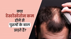 क्या टेस्टोस्टेरोन लेवल कम होने से पुरुषों के बाल झड़ते हैं? जानें एक्सपर्ट से
