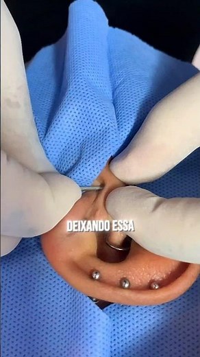 Surface Piercing Piercing performed on the Professional Body Piercing course✨#piercing #bodypiercing