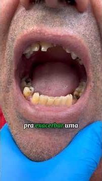 Formigamento, dormência, choques elétricos e perda de sensibilidade não devem ser ignorados.