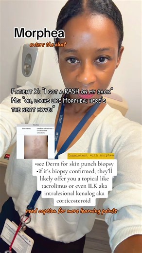 Morphea is localized scleroderma. Lesions can be thickened, sclerotic plaques. It will be biopsy proven. So here comes the Derm folks. My suspicion is just a suspicion. DERM is the main player here. They must confirm the diagnosis with a skin punch biopsy. BTW, this rash is: -somewhat itchy -may have positive ANA -is considered an autoimmune-related condition, due to immune system dysregulation #morphea #dermatology #medicine #rash | dr.q, the social MD | Facebook