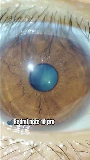 super macro, redmi note 10 pro. #redminote10pro #video