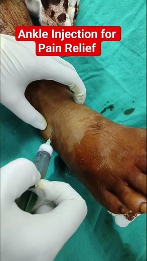 Ankle Injection for Pain Relief ✅
