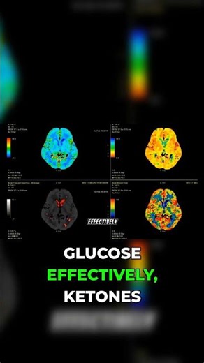 The Brain Superpower of BHB