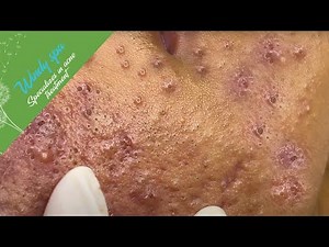 Make Your Day Relaxing with Windy Spa 6#159