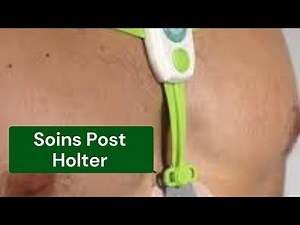 Post Holter Care