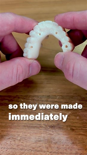3D Printed Teeth! | Green Lake Oral & Facial Surgery