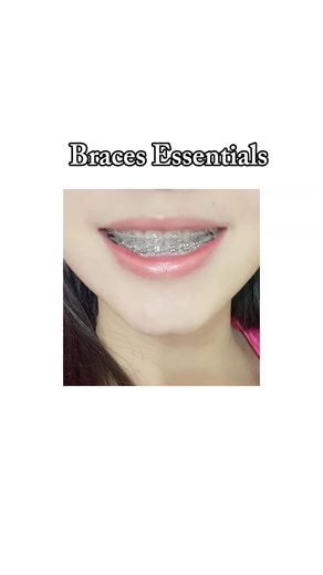braces essentials u need !! buy na! 😁 #hygienetok #bracestips #bracesessentials #essentials #foryou