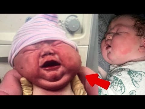 Tennessee Mom Gives Birth To 13-pound Baby — Doctors Gasp When They See Him