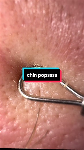 5 in 1 push!! 🦄 #pimples #satisfying #asmr #acne #skincare | skincare asmr