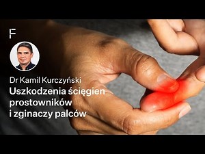 Injuries to the finger extensor and flexor tendons – causes, diagnosis, treatment
