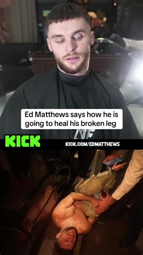 Healing Your Broken Leg Through Grounding Techniques