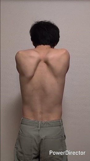 坂口氏が発見した「制御性T細胞（Tレグ細胞）」は免疫システムの中でどのような役割を担っているでしょうか。 #shorts