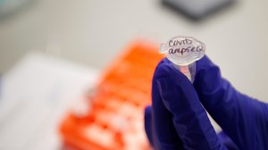 What does recovery from COVID-19 look like? It depends. A pulmonologist explains.