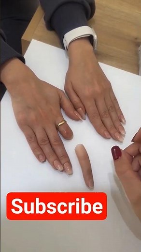 Realistic Silicone Finger Prosthesis | Life-Changing Transformation for Amputees #prostheticlimb