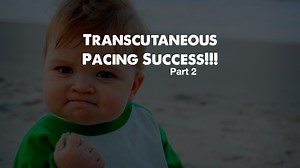 Transcutaneous Pacing Success!!! (Part 2)